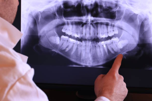 Best Emergency Tooth Extraction in Whitewright, TX